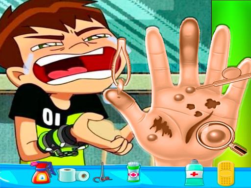 Ben10手部醫生遊戲